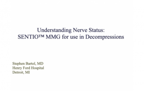 An image from the "SpineTIME: Understanding Nerve Status: Sentio™ MMG for use in Decompressions" video on the JnJInstitute.com website.