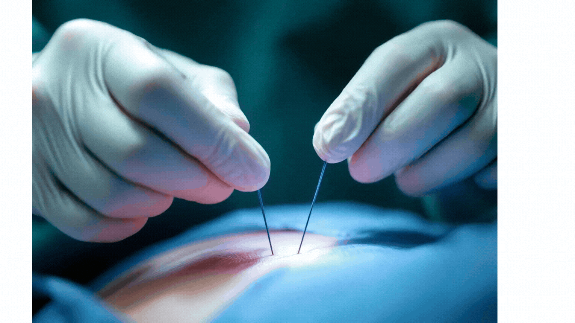 Surgery Fundamentals - Foundational Surgical Skills