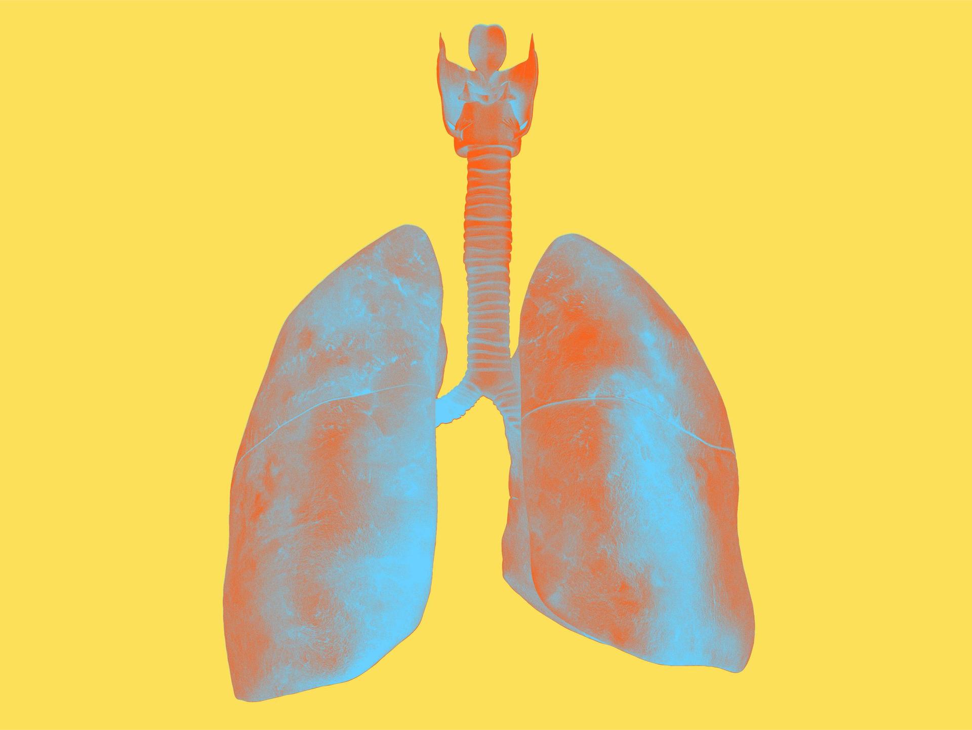 Bariatric Image