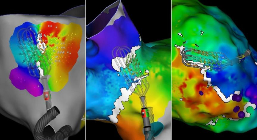 OPTRELL™ Mapping Catheter