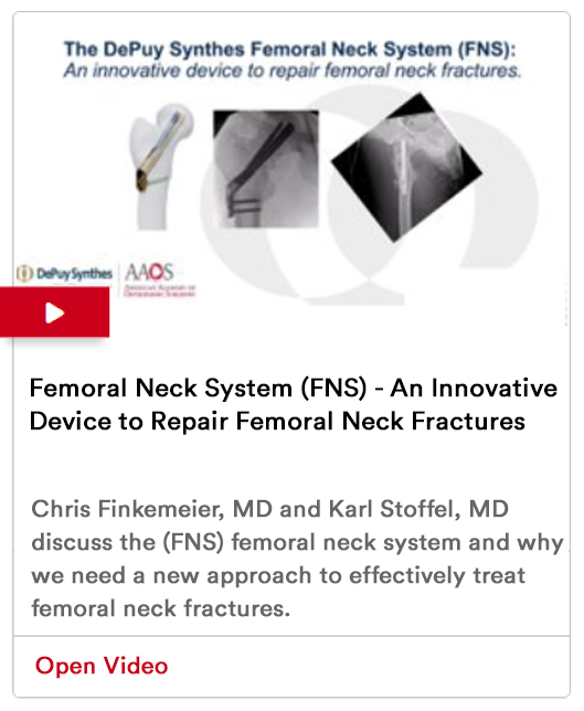 Femoral Neck Fractures Image