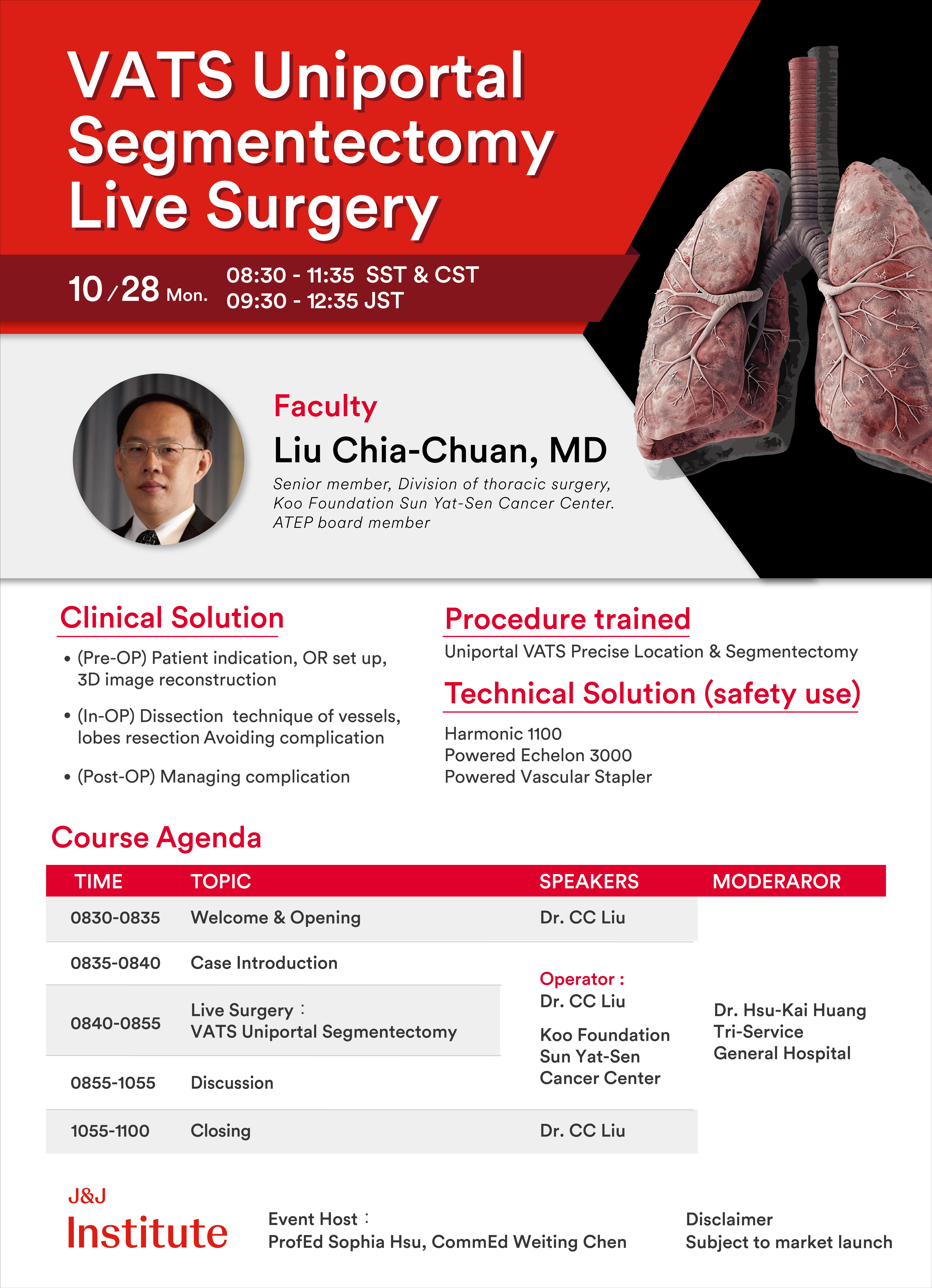 VATS Uniportal Segmentectomy Live Surgery