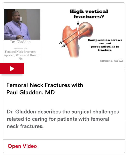 Femomral Neck Fractures Image