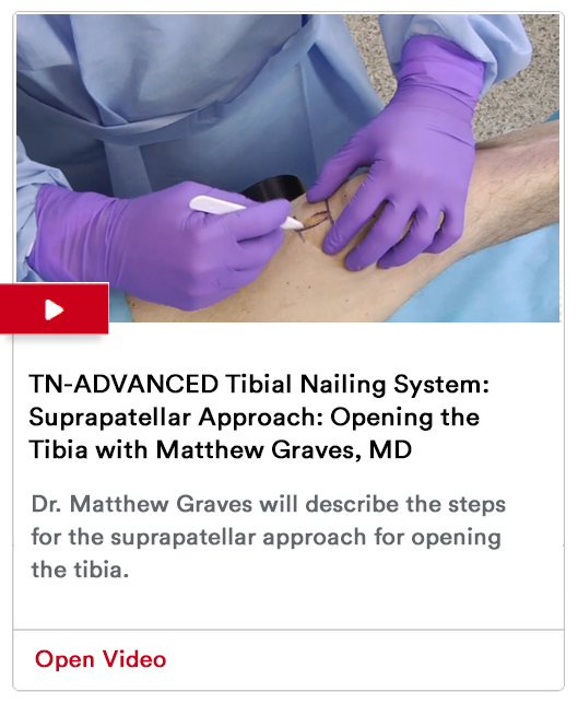 Opening the Tibia Image