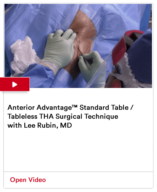 Anterior Advantage™ Standard Table / Tableless THA Surgical Technique with Lee Rubin, MD