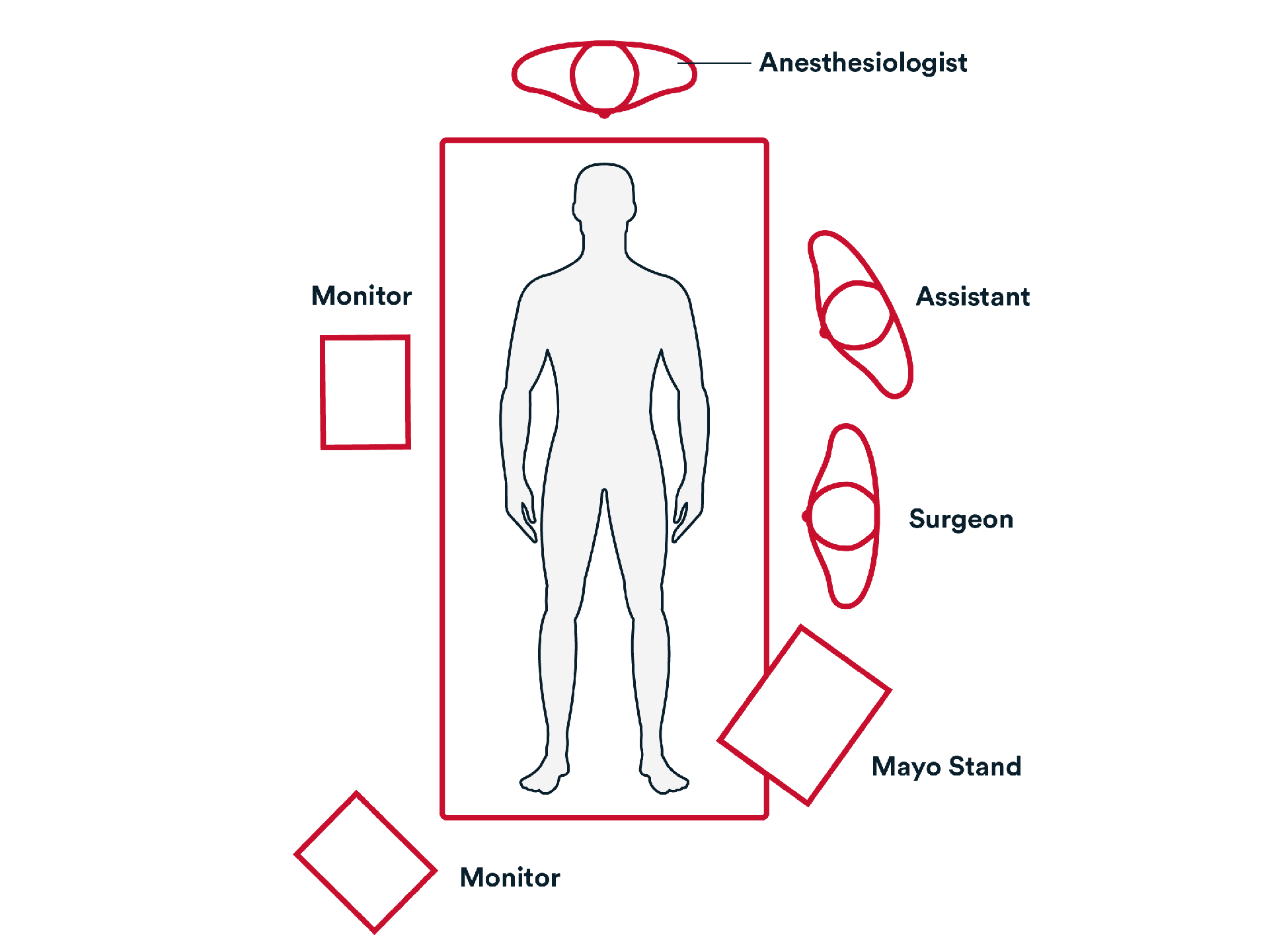 Appendectomy Image