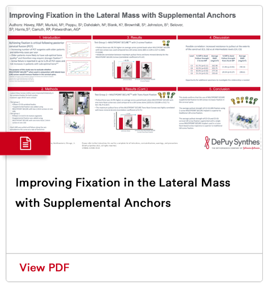 Image from Improving Fixation in the Lateral Mass