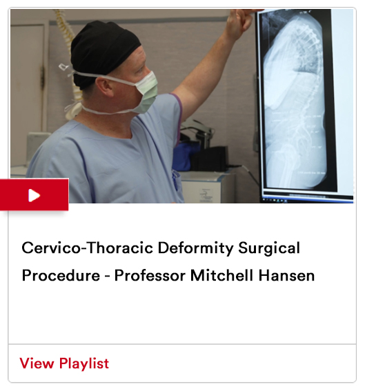 Image from Cervico-Thoracic Deformity Surgical Procedure