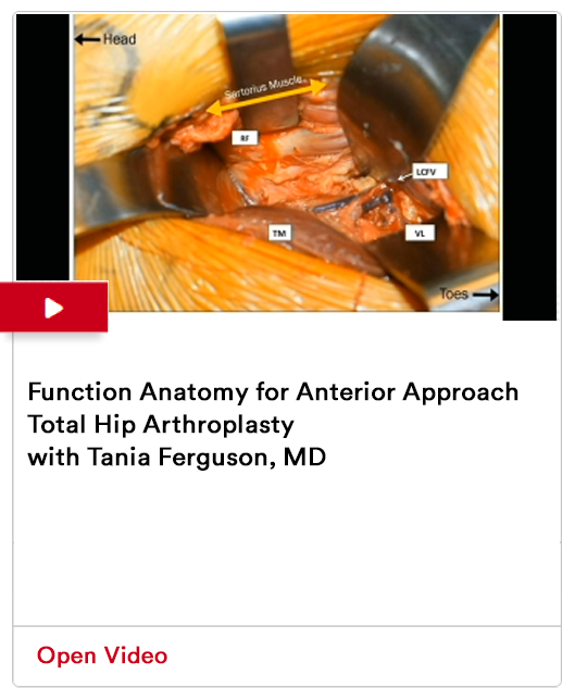 Function Anatomy for Anterior Approach Image