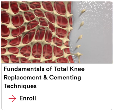 Fundamentals of TKR and Cementing Techniques