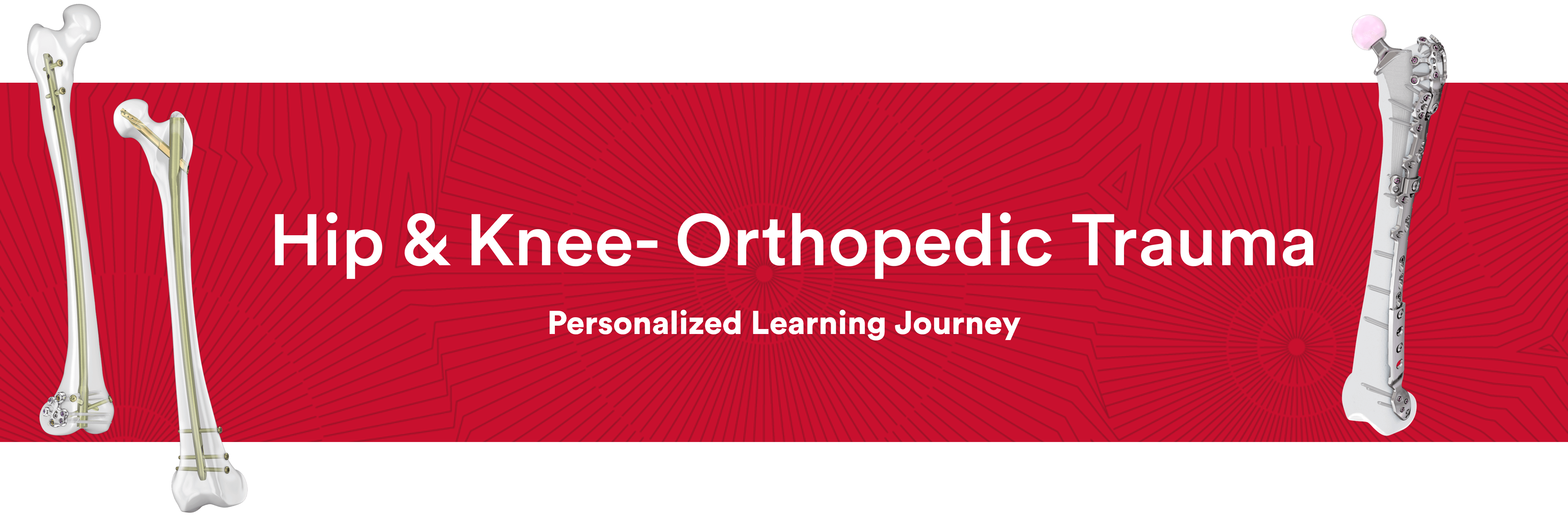 Hip and Knee Orthopaedic Trauma Banner Image
