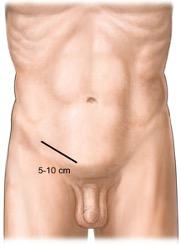Patient Positioning Image