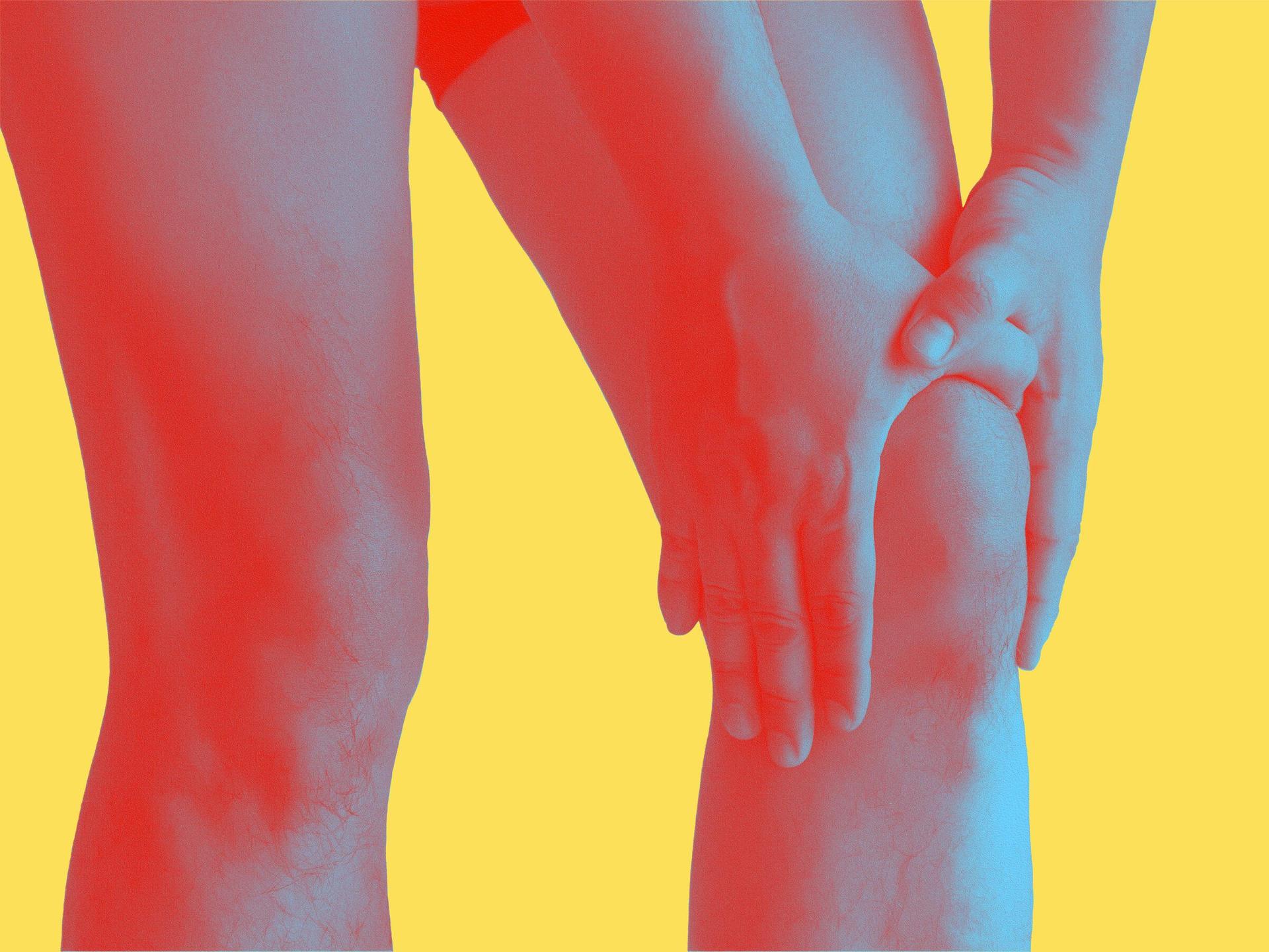 Joint Arthroplasty Image