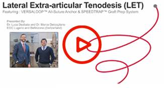 Lateral Extra-Articular Tenodesis
