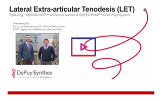 Lateral Extra-Articular Tenodesis (LET) with Drs. Luca Deabate & Marco Delcogliano Image