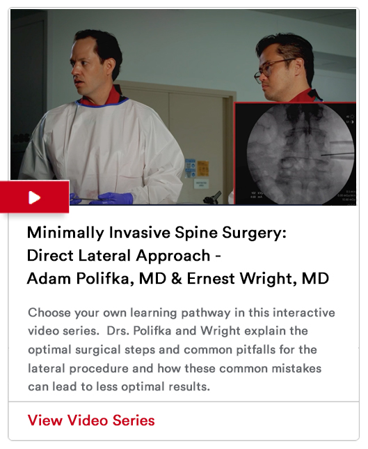 Minimally Invasive Spine Surgery Image