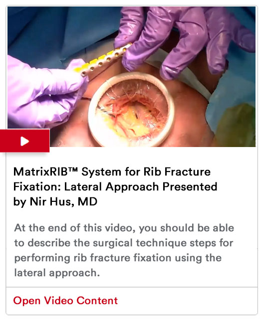 Rib Fixation Program Image