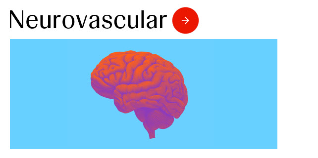 Neurovascular