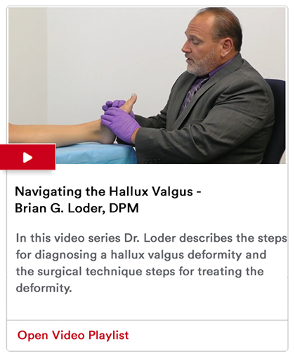 Navigating the Hallux Valgus Image