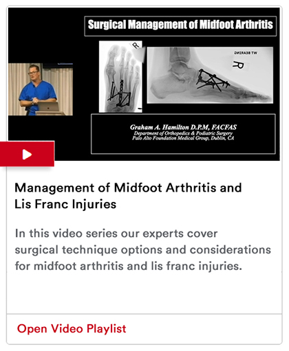 : Management of Midfoot Arthritis Image