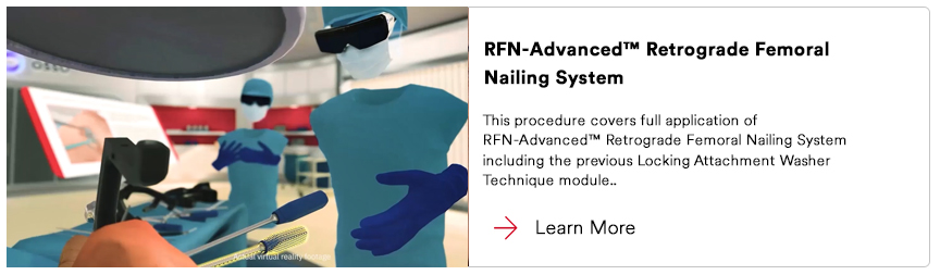 RFNA Retrograde Femoral Nailing Virtual Reality
