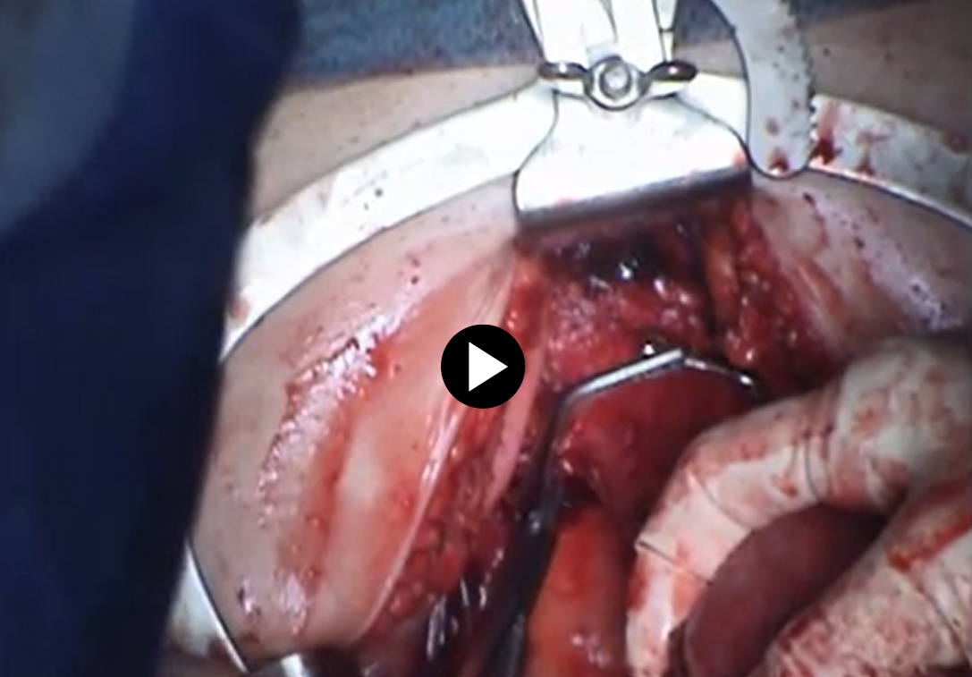 Right Angle Clamps
