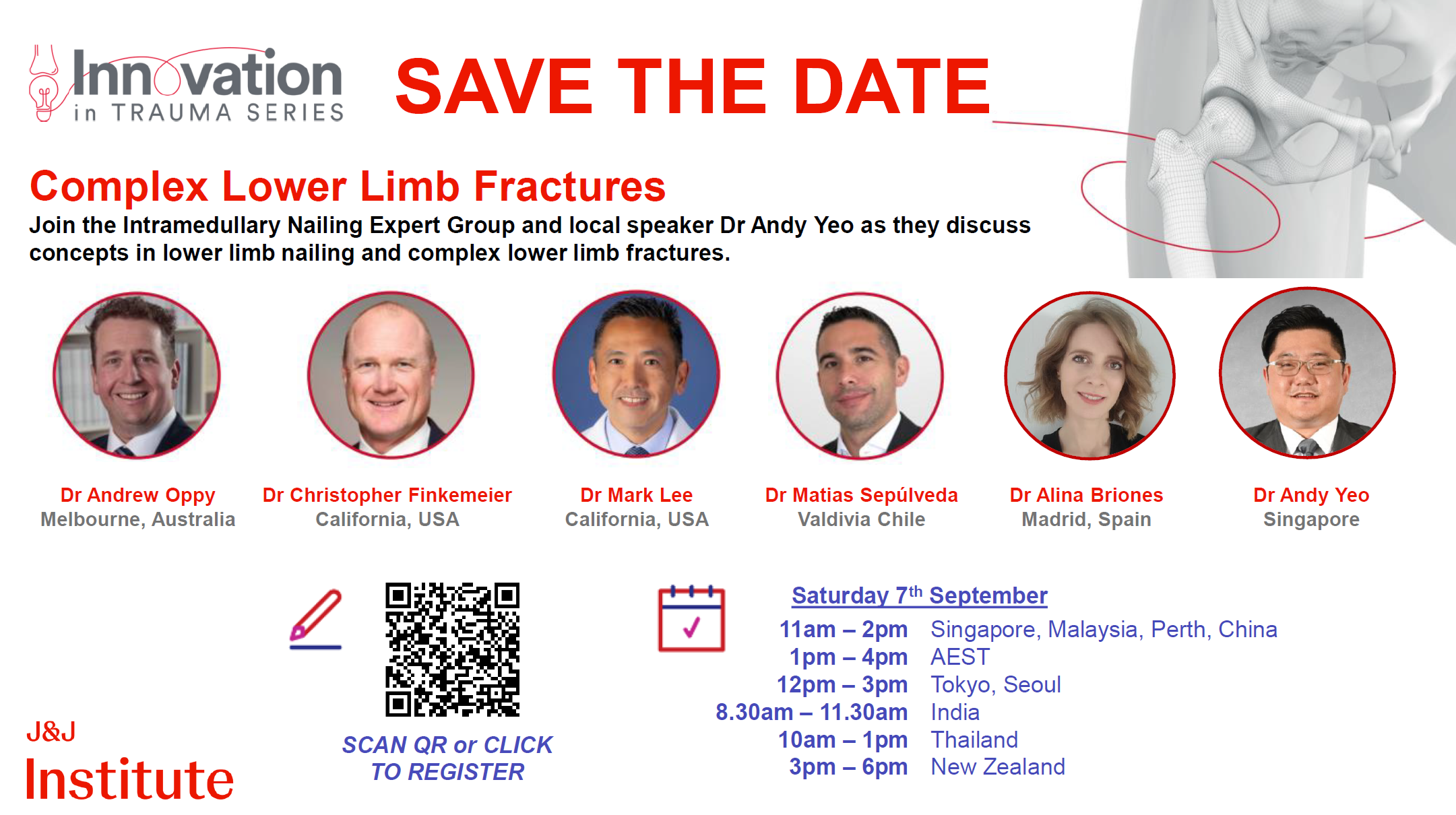 Complex Lower Limb Fractures