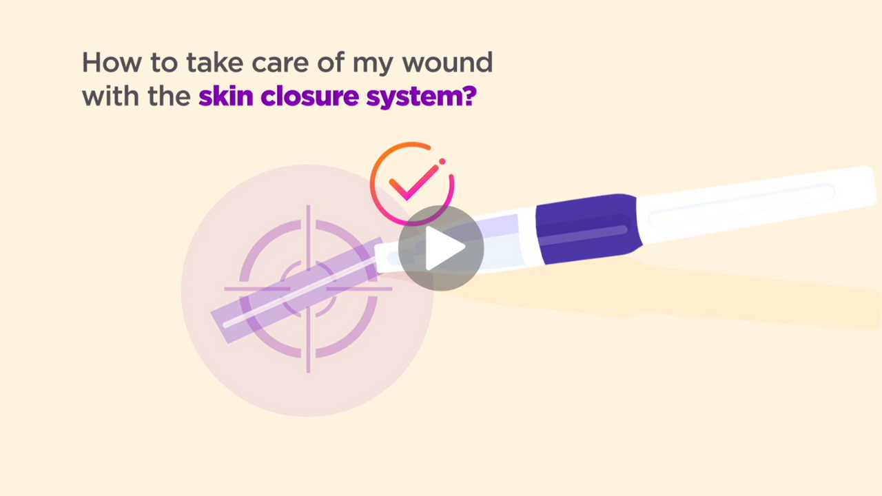 thumb how to care for your wound with skin closure system