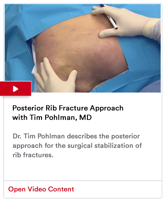 Posterior Rib Fracture Approach Image