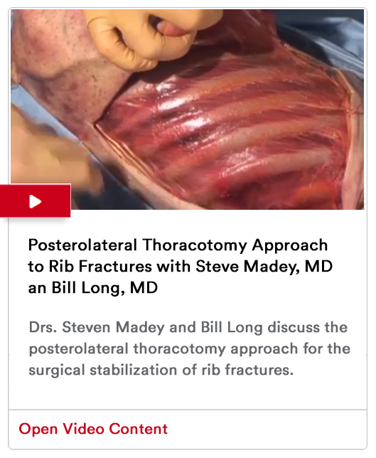 Posterolateral Thoracotomy Approach Image