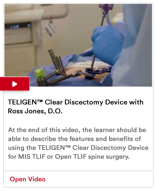 TELIGEN™ Clear Discectomy Device with Ross Jones, D.O. Video Image