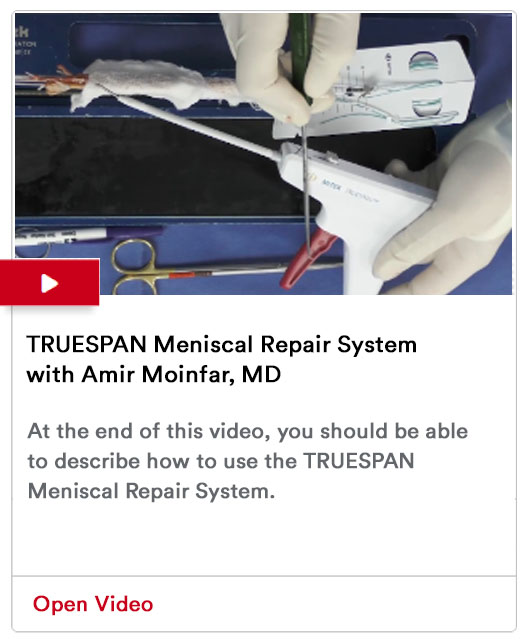 TRUESPAN Meniscal Repair System with Amir Moinfar, MD Video Image
