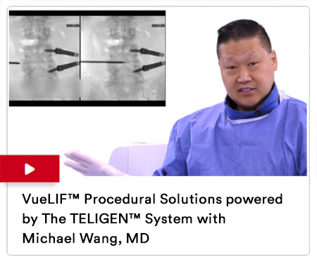 VueLIF Procedural Solutions powered by The TELIGEN System with Michael Wang, MD Image