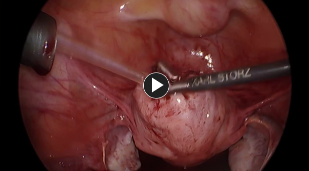 topical surgicel