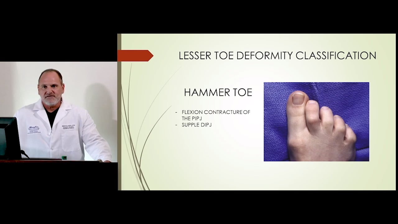 Surgery of the Lesser Toe Deformity with Brian G. Loder, DPM | Johnson &  Johnson Institute