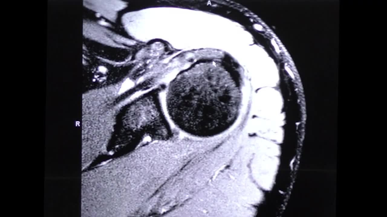 Standard Approach to reading an MRI; Procedural Walkthrough with ...