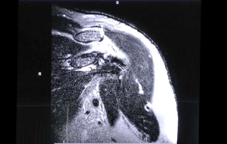 Surgeon's approach to Reading an MRI - Stephanie Muh, MD thumbnail