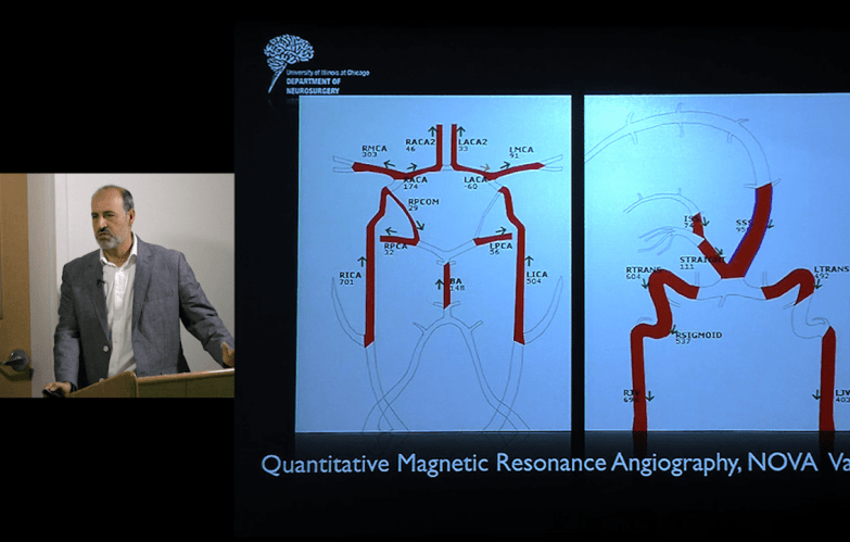 An image of the "The Role of Embolization in Treatment of AVM - Ali Alaraj, MD" video.