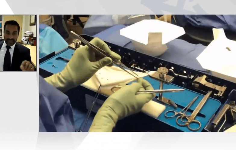 An image of the "Prepectoral Breast Reconstruction: Advances in Technique & Considerations in Optimizing Outcomes by Rahim Nazerali, MD" video on the JnJInstitute.com website.