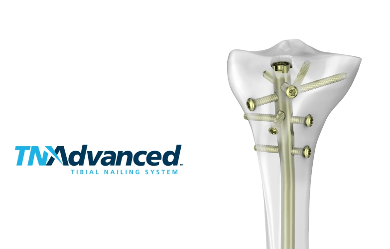 An image from the "TFN-ADVANCED Tibial Nailing System: Distal Locking with Matthew Graves, MD" video on the JnJInstitute.com website.