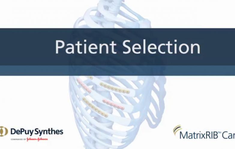 An image of the "MatrixRIB™ Care - How To Start A Rib Fixation Program with Andrew Doben, MD" video.