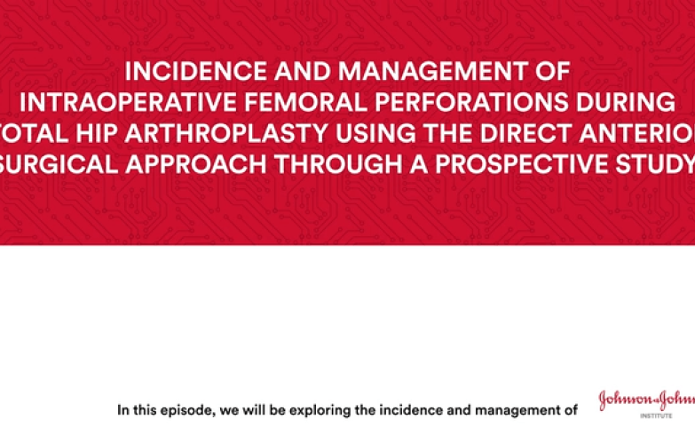 Incidence & management of intraoperative femoral perforations during total hip arthroplasty using the direct anterior surgical approach thumbnail