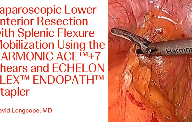 Laparoscopic Lower Anterior Resection with Splenic Flexure Mobilization 
