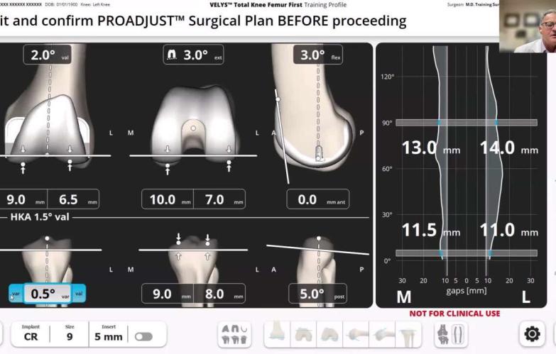 VELYS Robotic-Assisted Solution Case Walkthrough with Dr. Christopher Drinkwater thumbnail image
