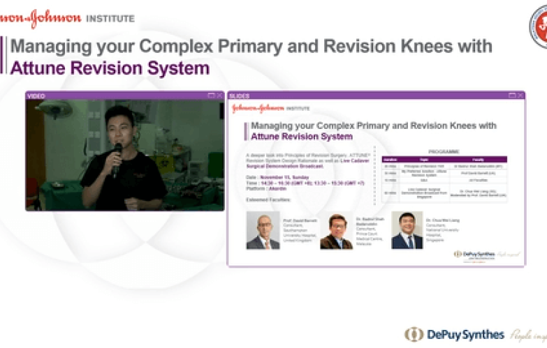 SEA Webinar - Managing Complex Primary & Revision Knees with Attune Revision & Live Surgical Demonstration thumbnail