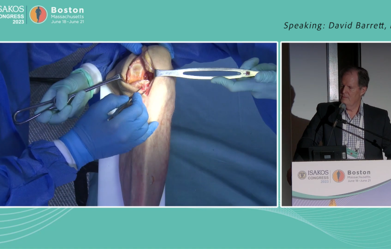 Unicompartmental Knee Procedural Workflow - David Barrett, MD & David Dalury, MD thumbnail image