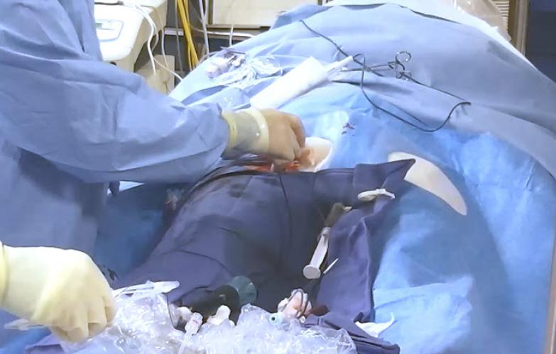 An image of the "Utilizing Intracardiac Echo During Transseptal Puncture with Brett Gidney, MD" video on the JnJInstitute.com website.
