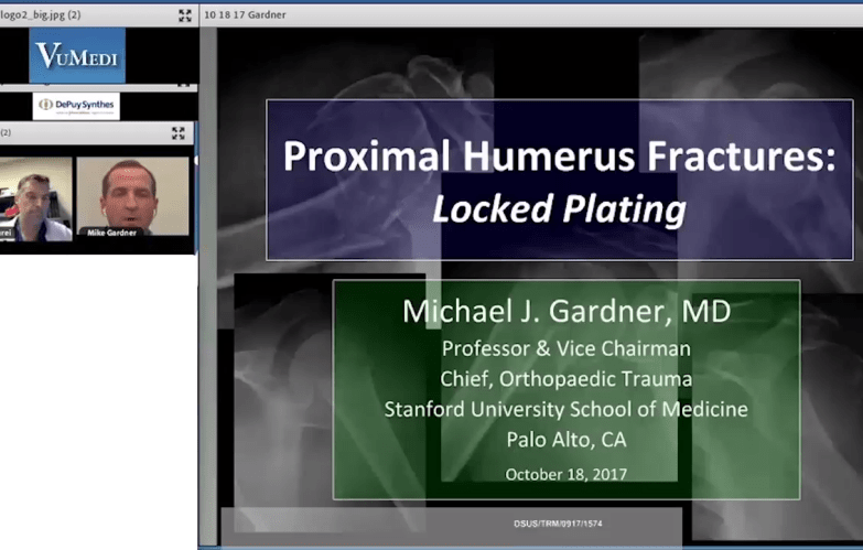 An image of the "Proximal Humerus Fractures - Locked Plating with Michael Gardner, MD" video on the JnJInstitute.com website.