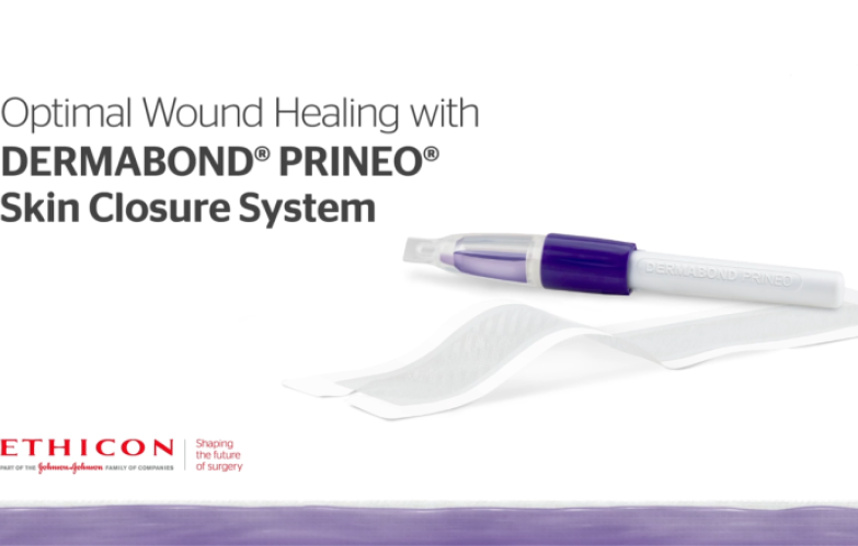 An image from the "Reducing Wound Drainage with New Skin Closure Systems by Liza Ovington, MD" video on the JnJInstitute.com website.