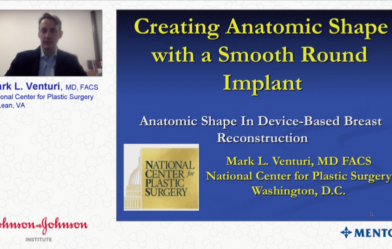 An image from the "Creating Anatomic Shape with Smooth Round Implants with Mark Venturi, MD" video on the JnJInstitute.com website.